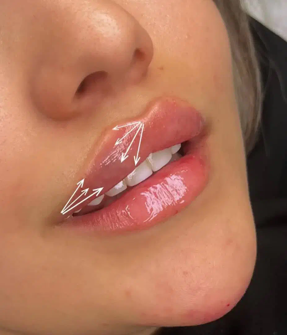 کانتورینگ لیفت فیلر بوتاکس مزو|خدمات آرایشگری و زیبایی|اصفهان, سپاهان‌شهر|دیوار