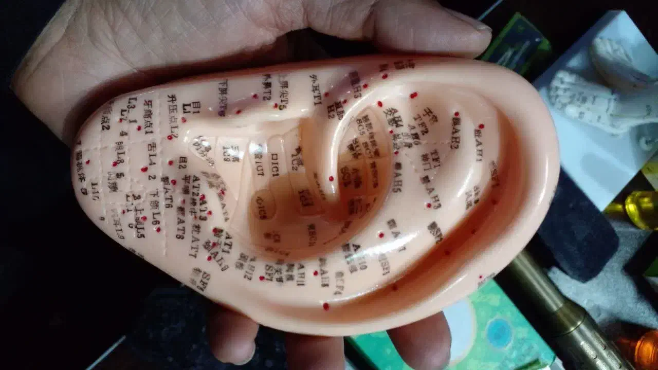 اموزش طب سوزنی|خدمات آموزشی|اصفهان, آزادگان|دیوار