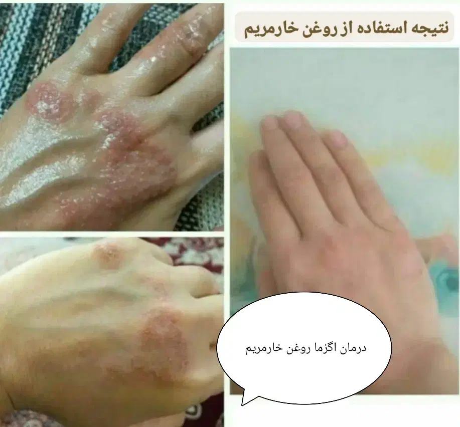 روغن های گیاهی کاژان|آرایشی، بهداشتی، درمانی|تربت‌حیدریه, شهرک ولیعصر|دیوار