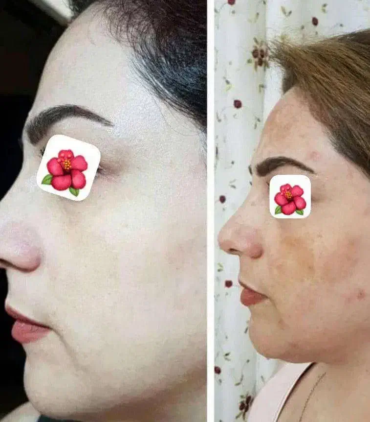 کرم اماراتی عصل مروه گلی|آرایشی، بهداشتی، درمانی|میبد, |دیوار