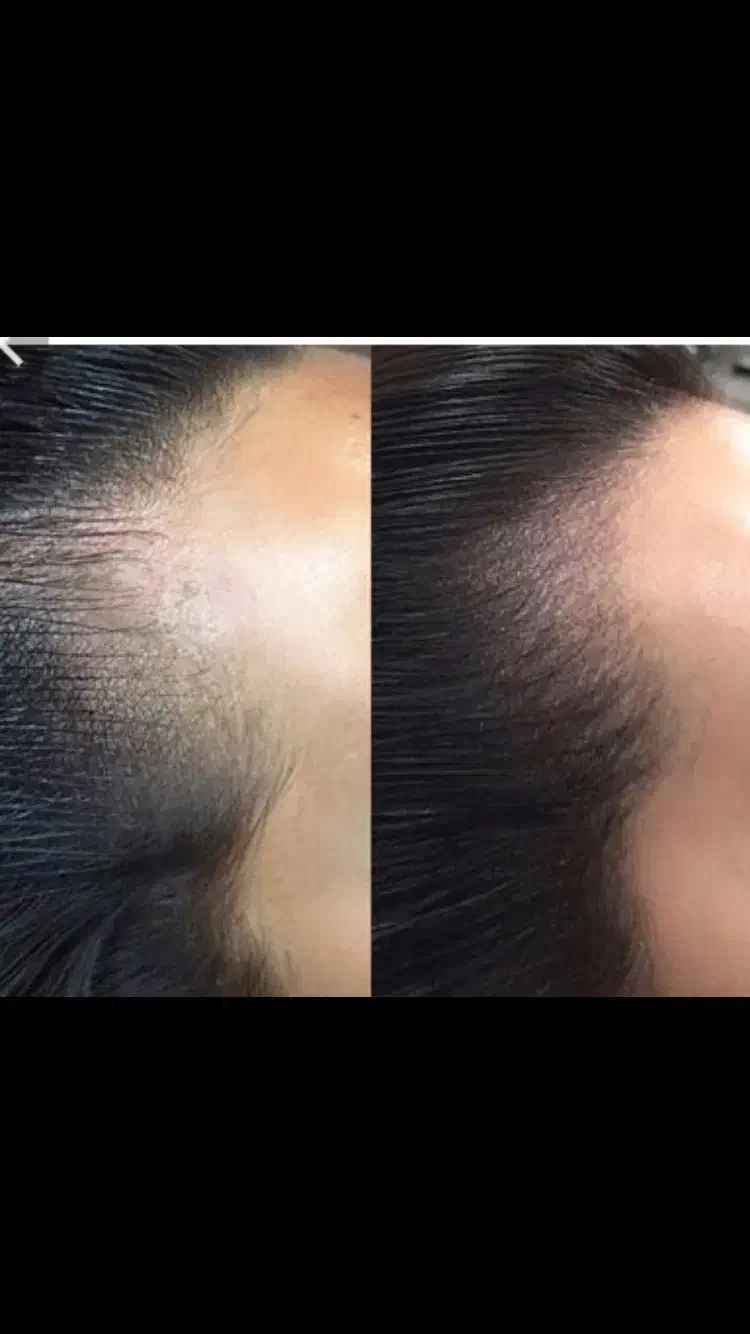 اسکالپ سر|خدمات آرایشگری و زیبایی|گرگان, |دیوار