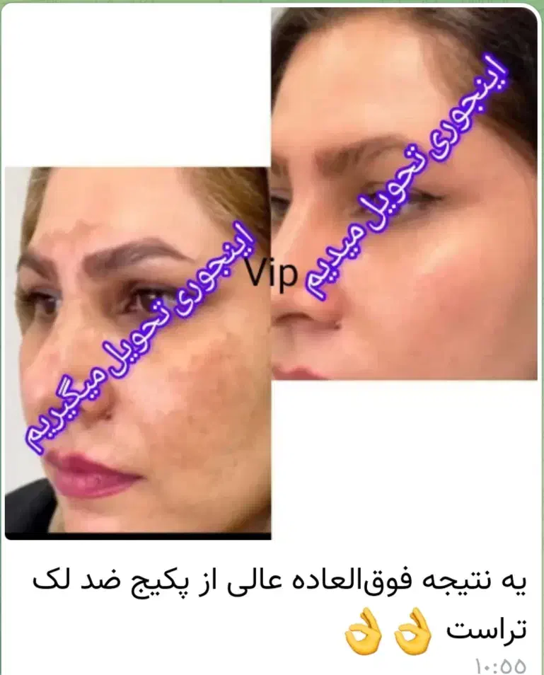 سارا محمدپور هستم|آرایشی، بهداشتی، درمانی|تهران, آزادشهر|دیوار