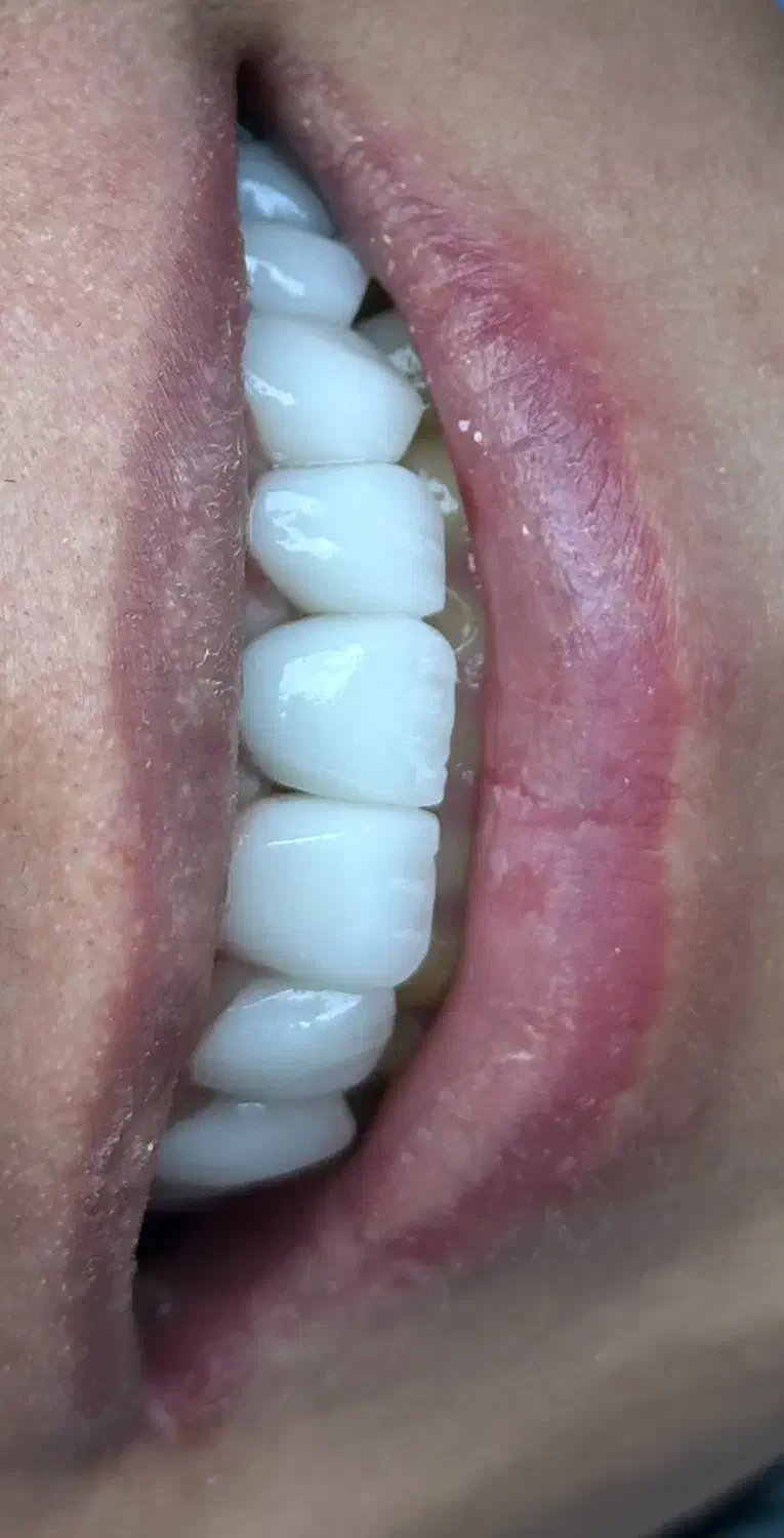 دندانپزشکی در آخونی|خدمات آرایشگری و زیبایی|تبریز, |دیوار