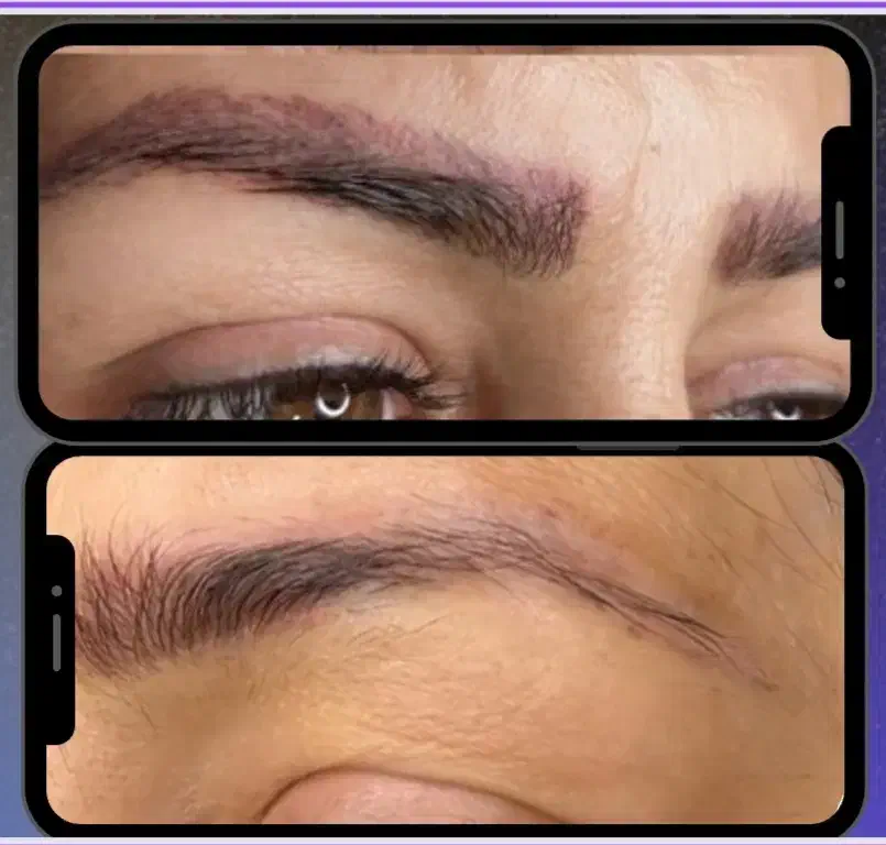 ریموو تاتو، پاک کردن تتو تخصصی کرج، البرز|خدمات آرایشگری و زیبایی|کرج, عظیمیه|دیوار