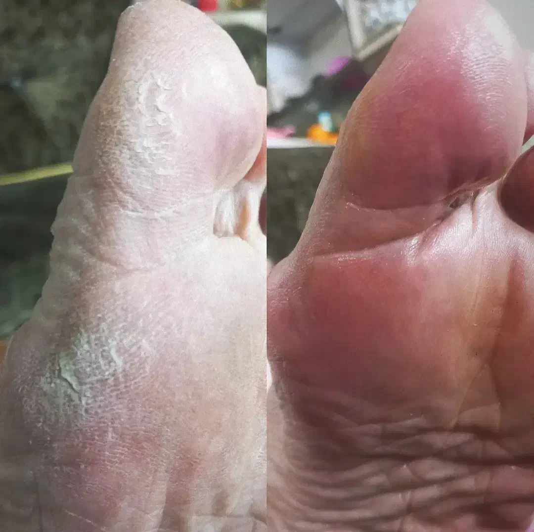 پدیکور و کف سابی کف پا|خدمات آرایشگری و زیبایی|آمل, |دیوار