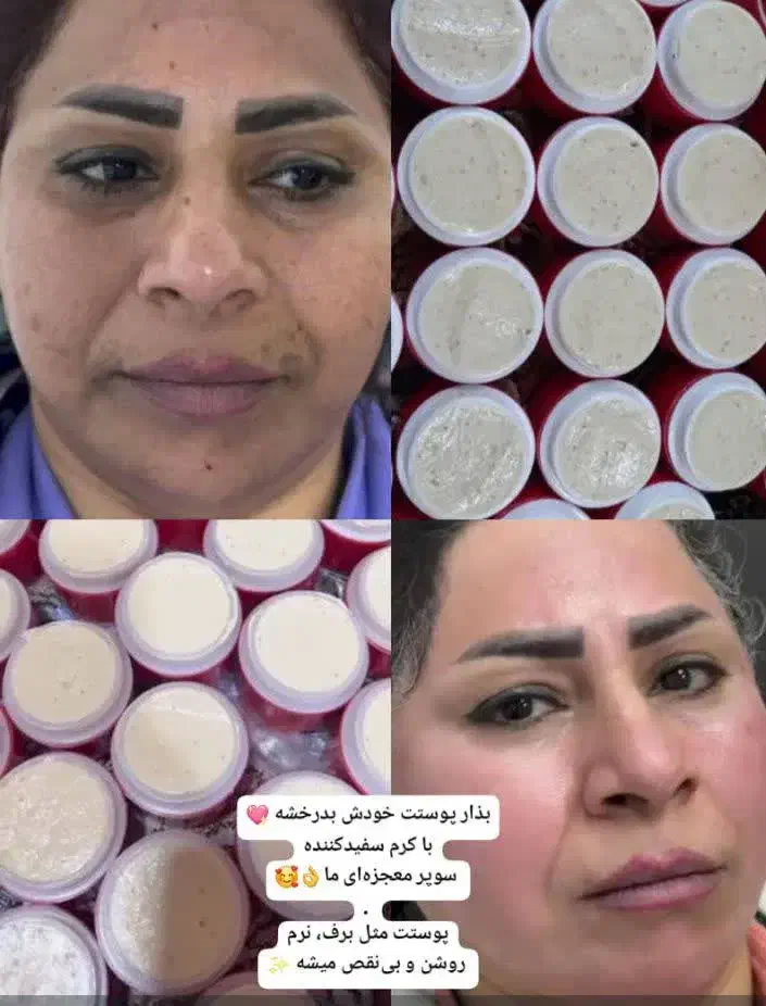 کرم سوپر معجزه اصل|آرایشی، بهداشتی، درمانی|قم, شاه احمد قاسم|دیوار