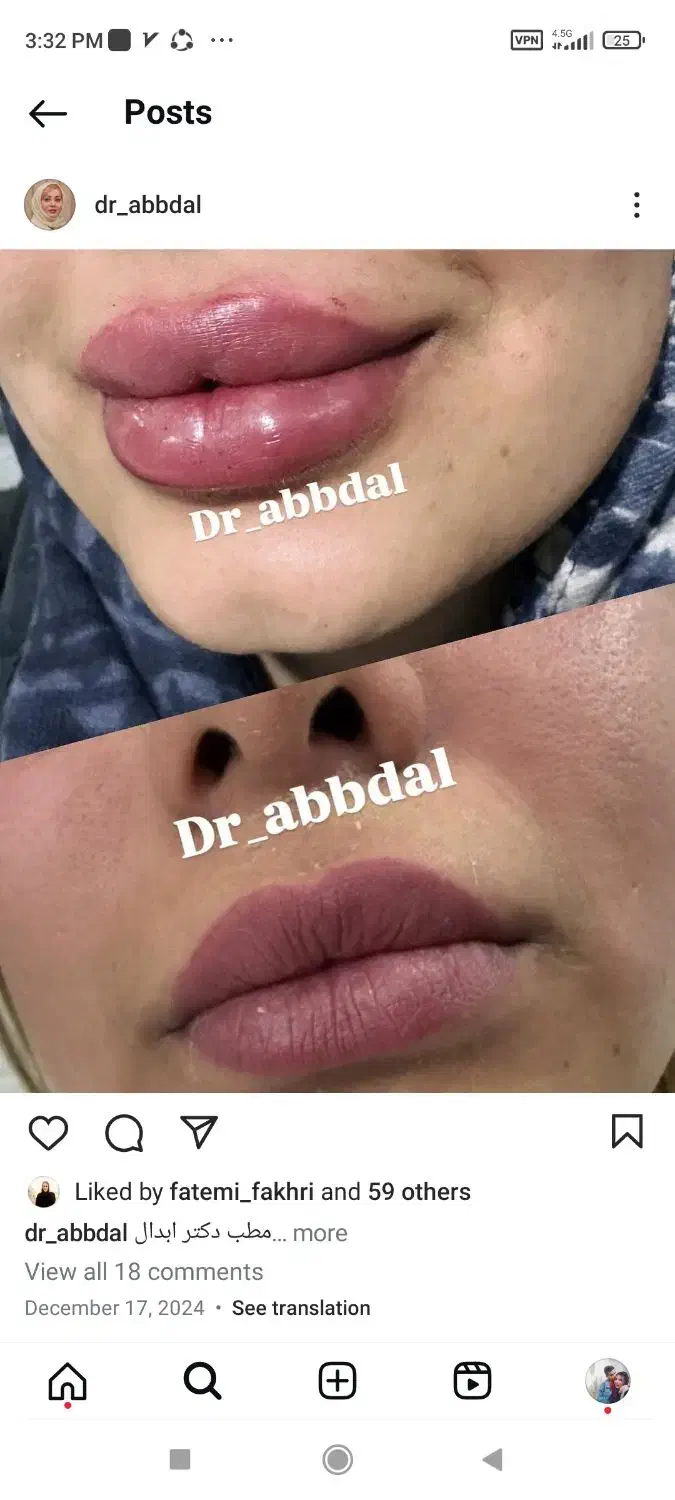 خدمات زیبایی بدن وصورت|خدمات آرایشگری و زیبایی|اصفهان, ملک‌شهر|دیوار