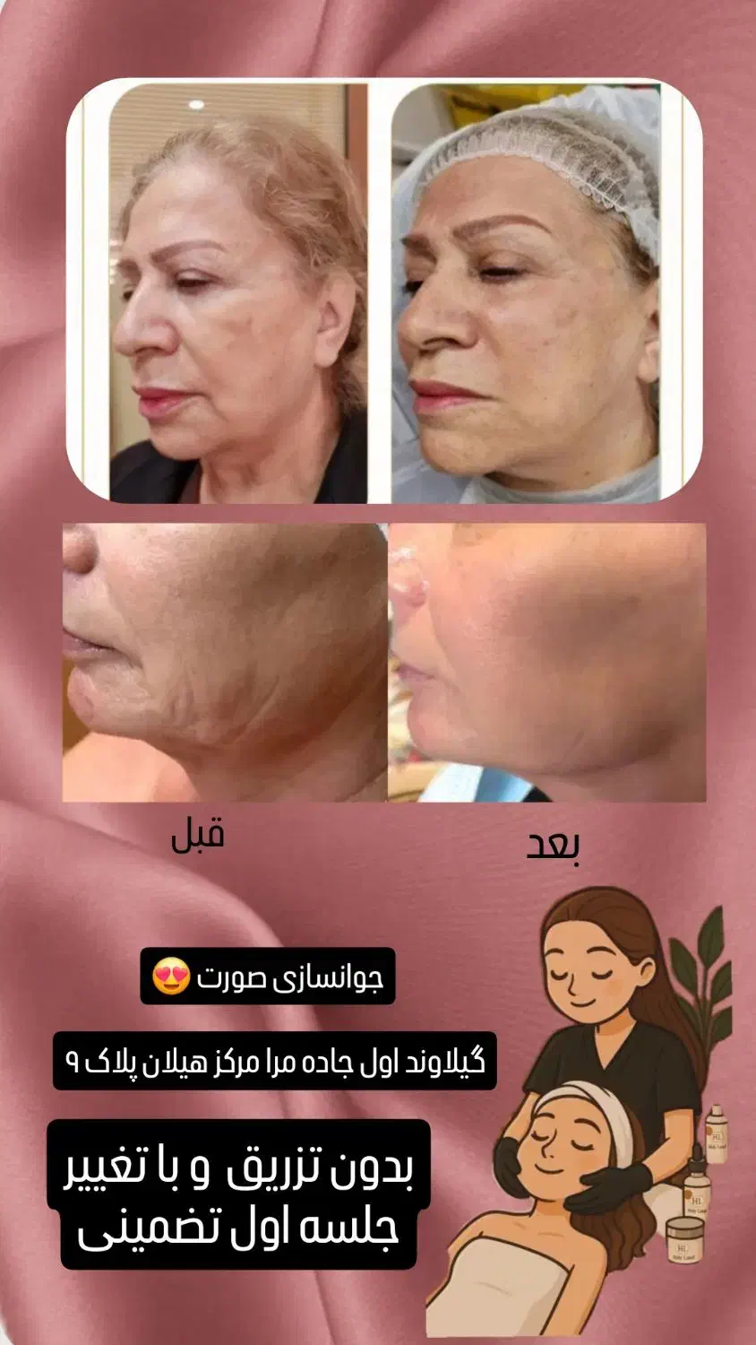 جوانسازی|خدمات آرایشگری و زیبایی|دماوند, دماوند|دیوار