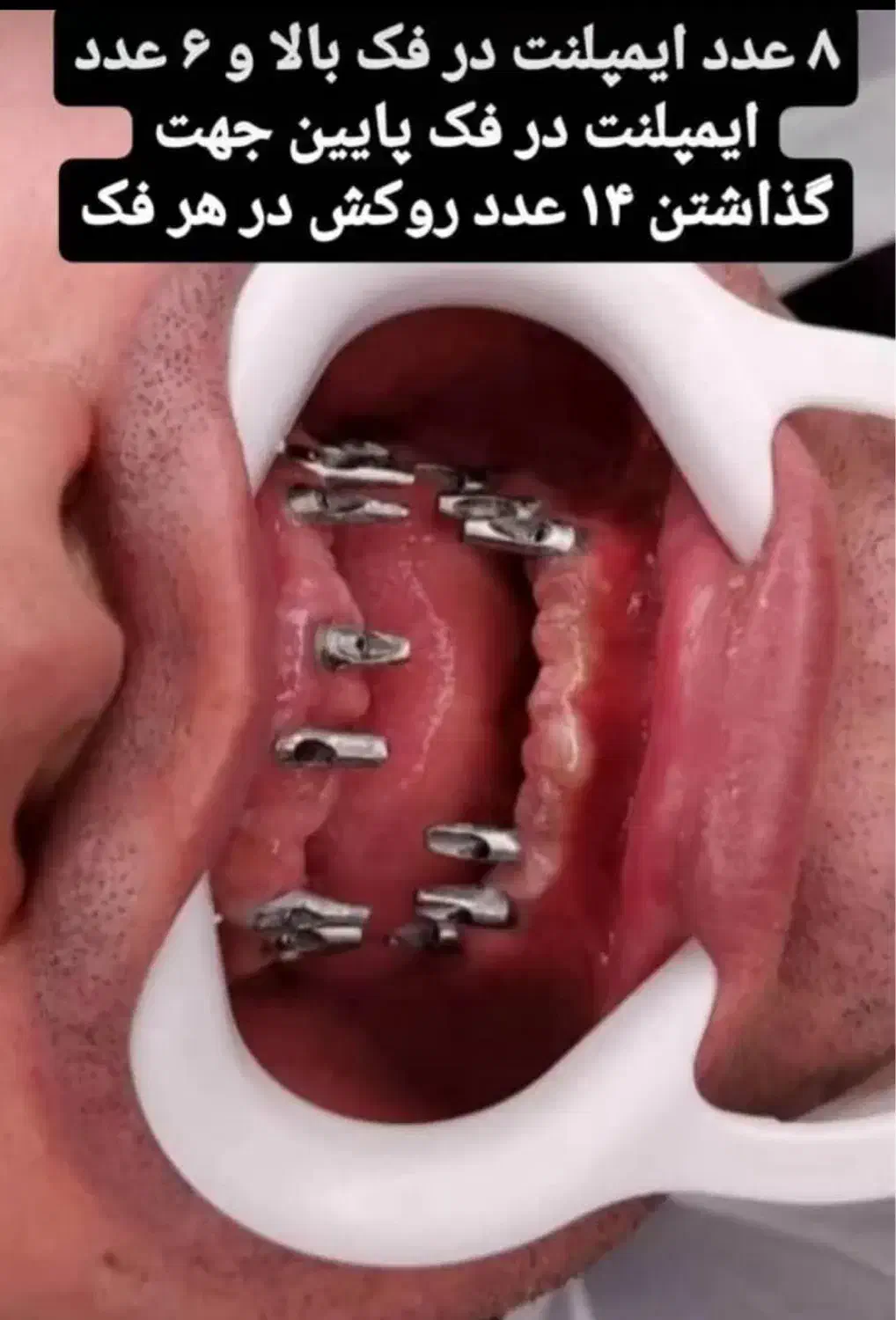 دندانپزشکی اقساطی با وام قرض الحسنه|خدمات آرایشگری و زیبایی|اصفهان, لاله|دیوار