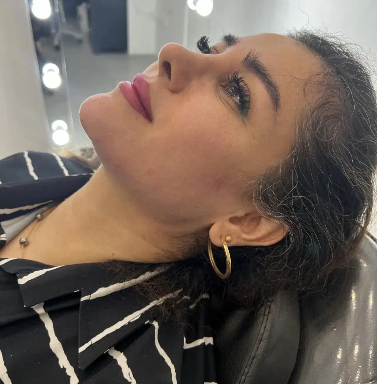 تزریق ژل و انواع مزو ژل های جوانساز|خدمات آرایشگری و زیبایی|بوشهر, |دیوار