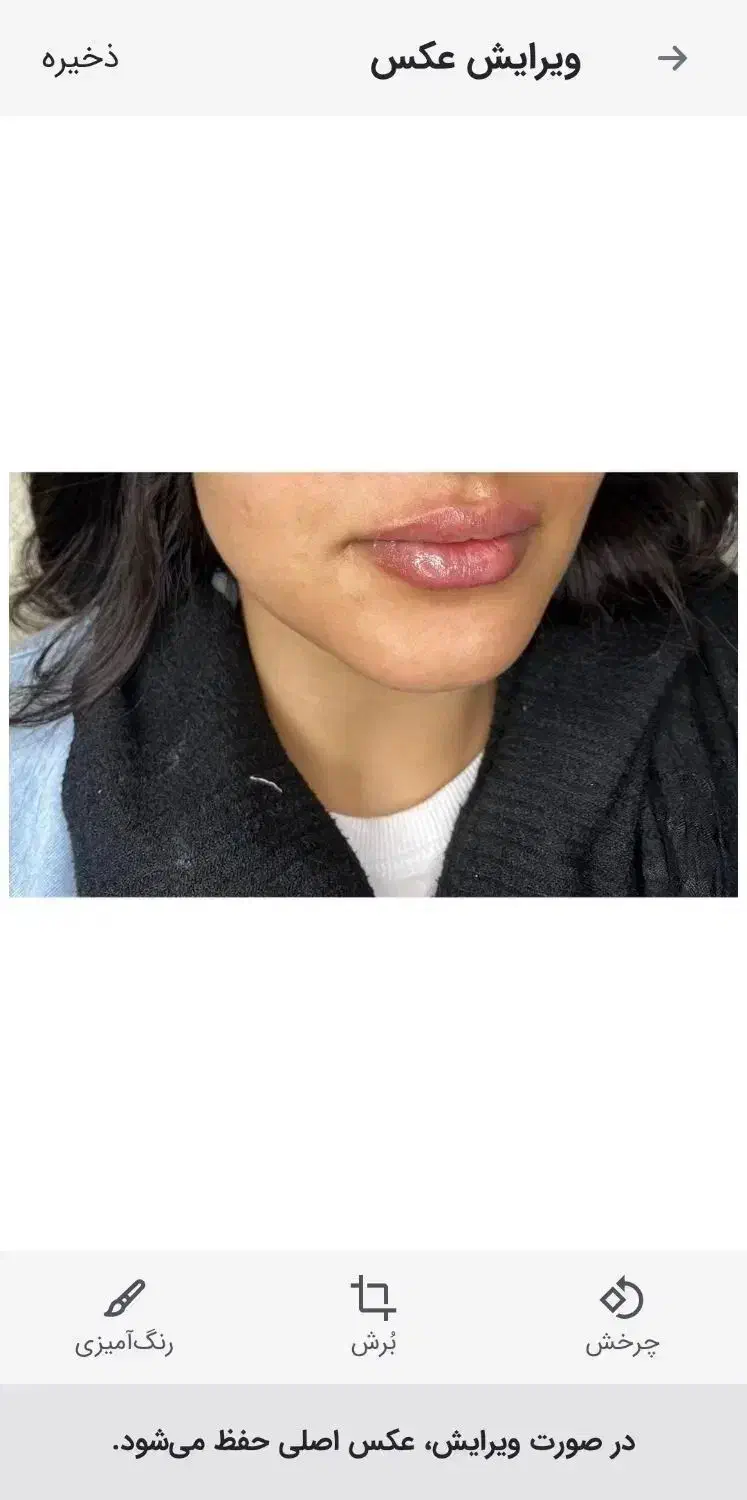 بوتاکس،فیلر،مزوژل باتخفیفی که نمی‌خوای از دست بدی|خدمات آرایشگری و زیبایی|شیراز, میرزاکوچک خان|دیوار