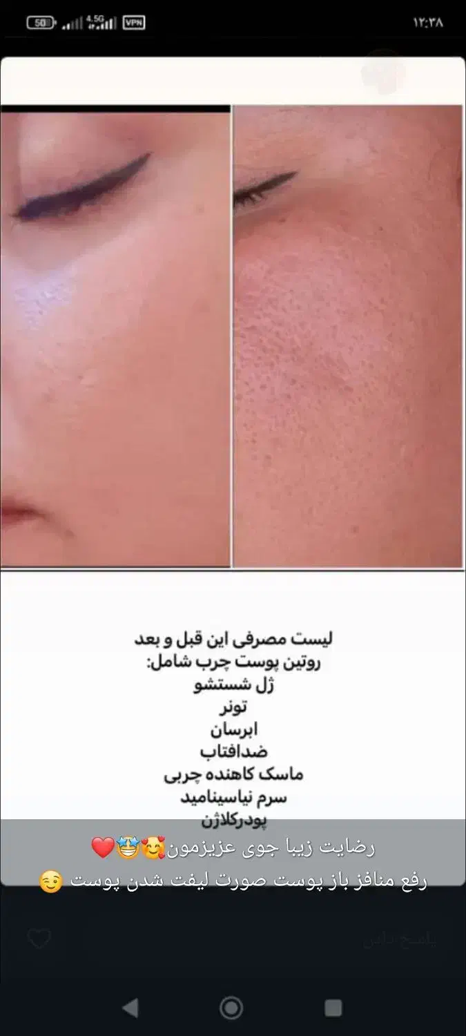 آرایشی وبهداشتی|آرایشی، بهداشتی، درمانی|قم, بنیاد|دیوار