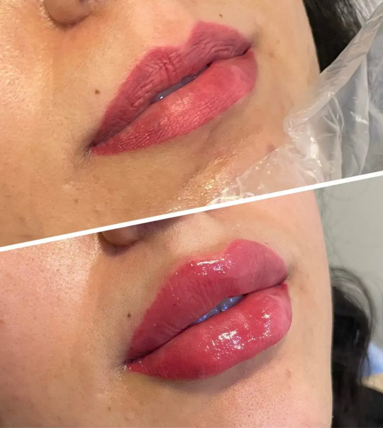 مطبپوست مو لیزر ولاغری|خدمات آرایشگری و زیبایی|مشهد, ایثار|دیوار