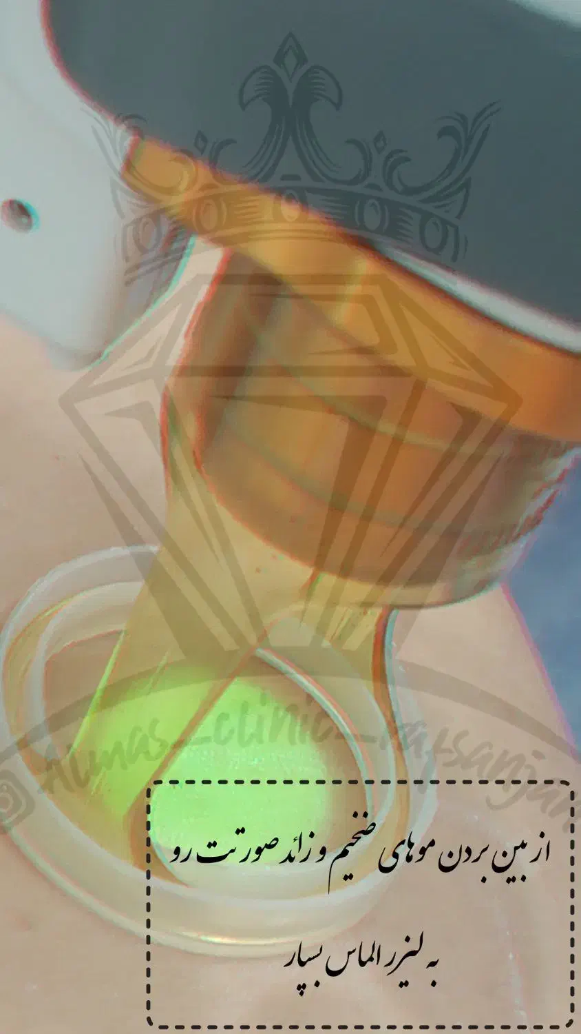 اپراتور آقا لیزر|استخدام درمانی، زیبایی، بهداشتی|رفسنجان, |دیوار