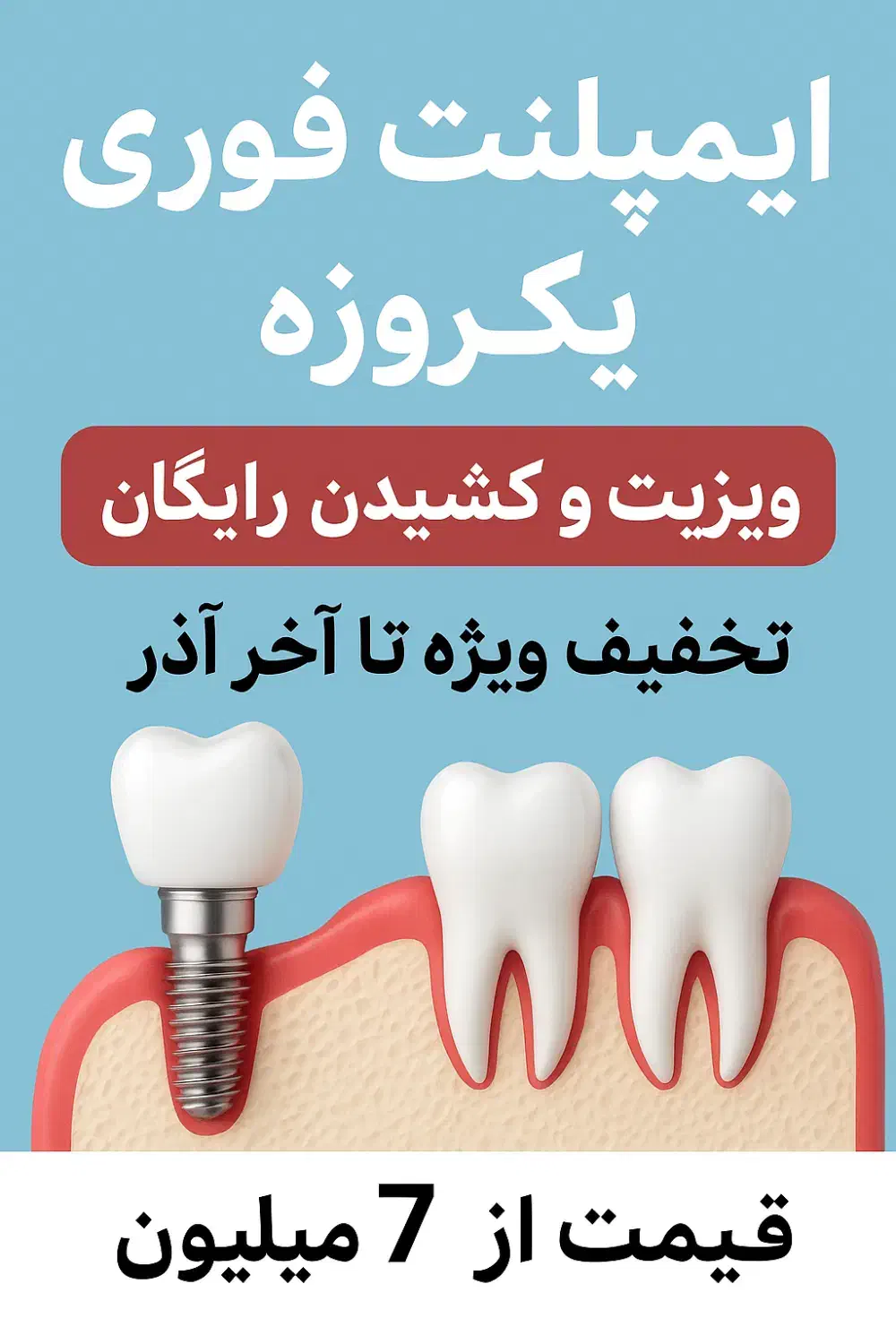 ایمپلنت تخصصی از ۷میلیون+ اوردنچر/ تخفیف تاآخرآذر|خدمات آرایشگری و زیبایی|اصفهان, جلفا|دیوار