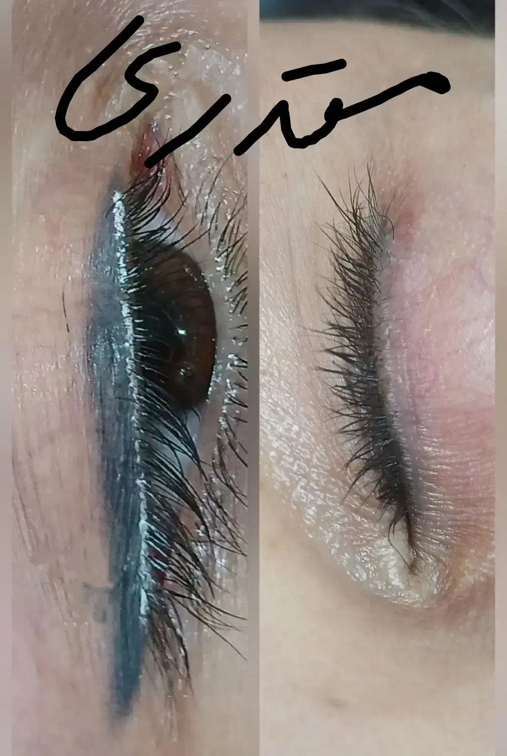 مرکز تخصصی ریموو تتو.شیدینگ لب.میکرو.آموزش|خدمات آرایشگری و زیبایی|گرگان, |دیوار