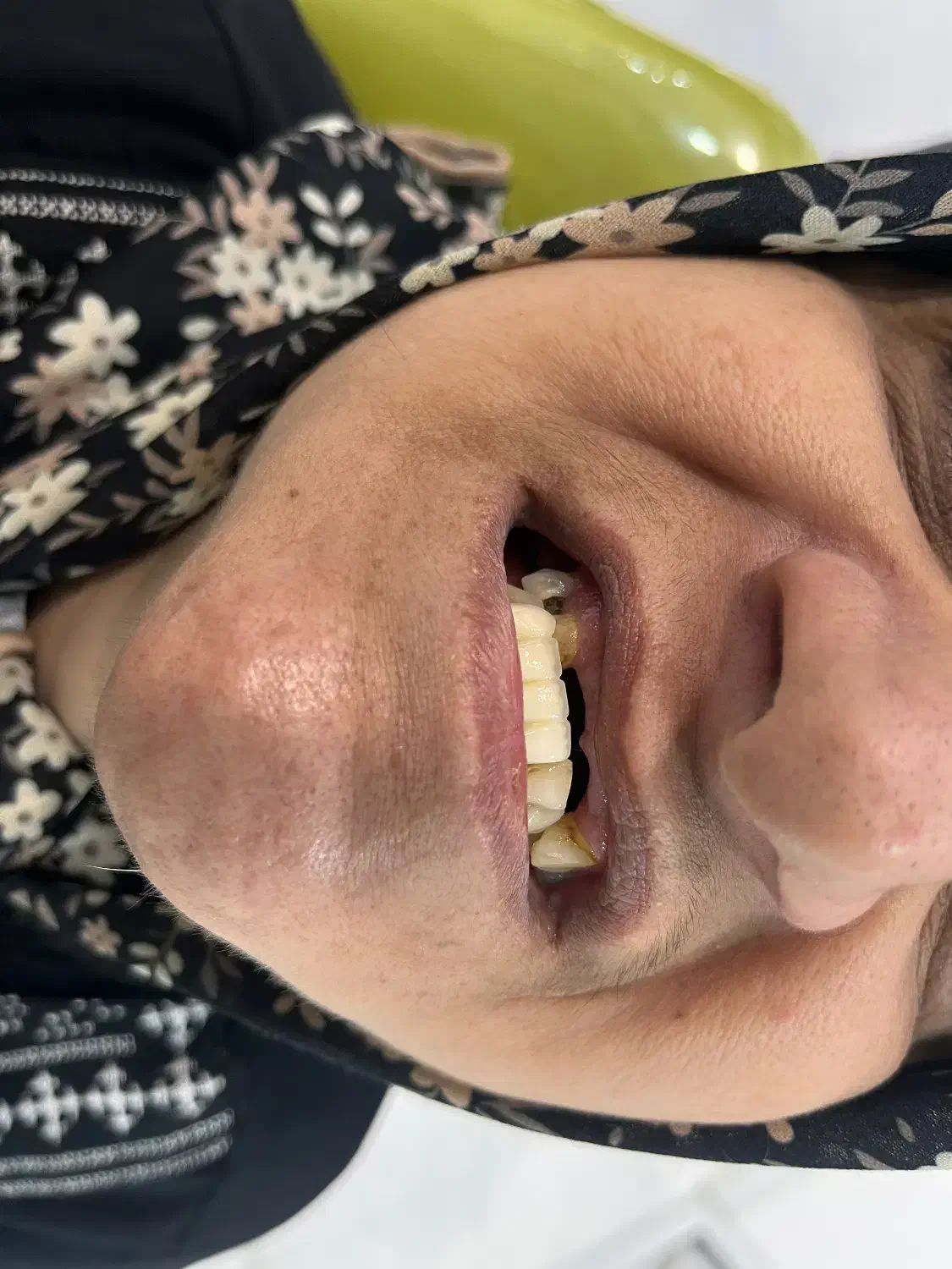 خدمات دندانسازی مروارید|خدمات آرایشگری و زیبایی|دهدشت, |دیوار