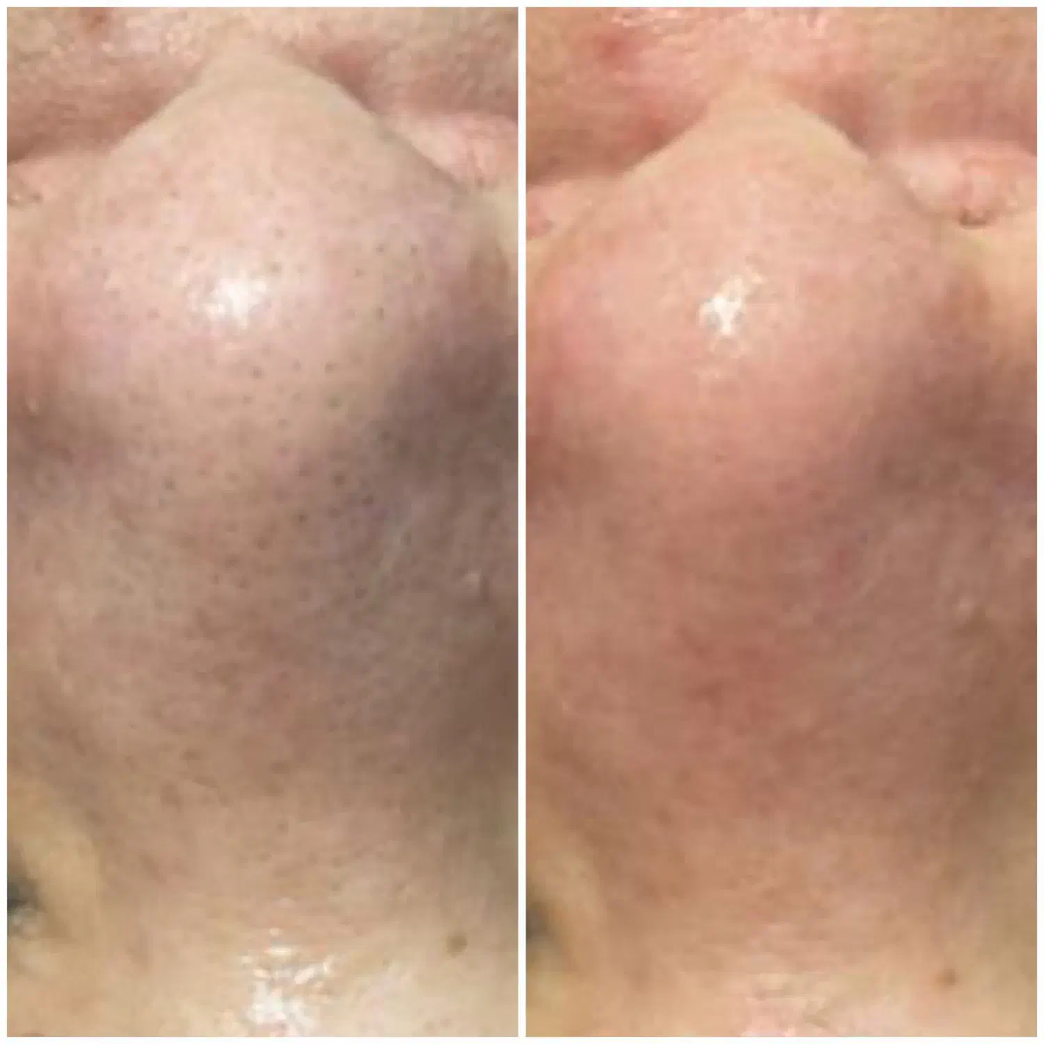 پاکسازی،کربوکسی با تخفیف50 ٪ برای اقایان بانوان|خدمات آرایشگری و زیبایی|بیرجند, |دیوار