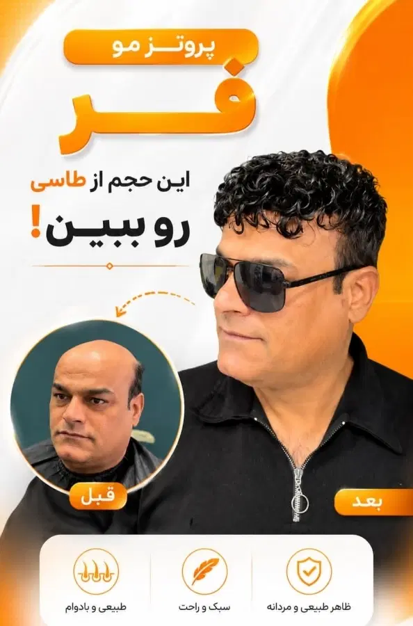 پروتزموپرپشتی مو بدون عمل و دردوخونریزی باضمانت|خدمات زیبایی و سلامت|اصفهان, گلزار|دیوار
