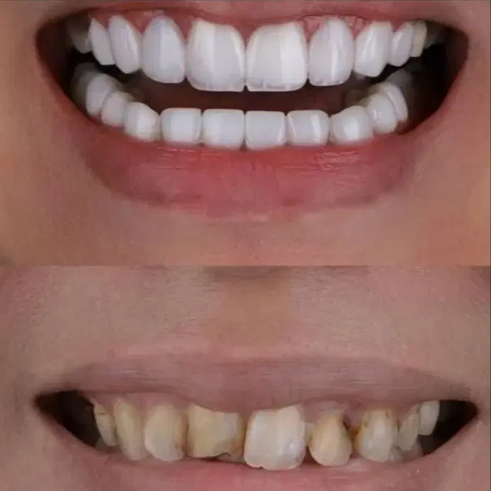 کلینیک دندانپزشکی پرلین زیبایی و درمانی|خدمات زیبایی و سلامت|تهران, تهرانپارس جنوبی|دیوار