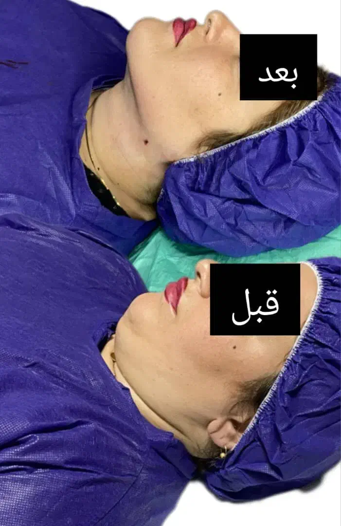 ساکشنغبغب|خدمات آرایشگری و زیبایی|یاسوج, |دیوار