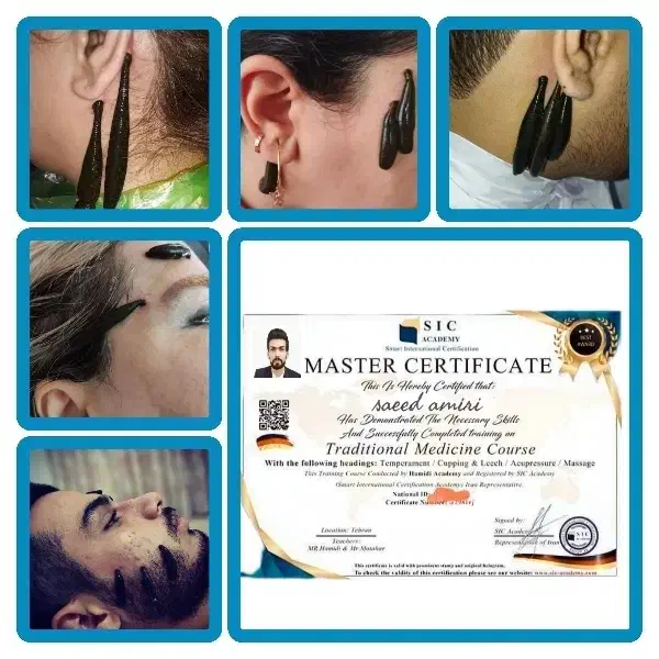 حجامت/بادکش/زالو/ناف گیر/ماسـاژدرمنــزل شـما|خدمات آرایشگری و زیبایی|کرمانشاه, |دیوار