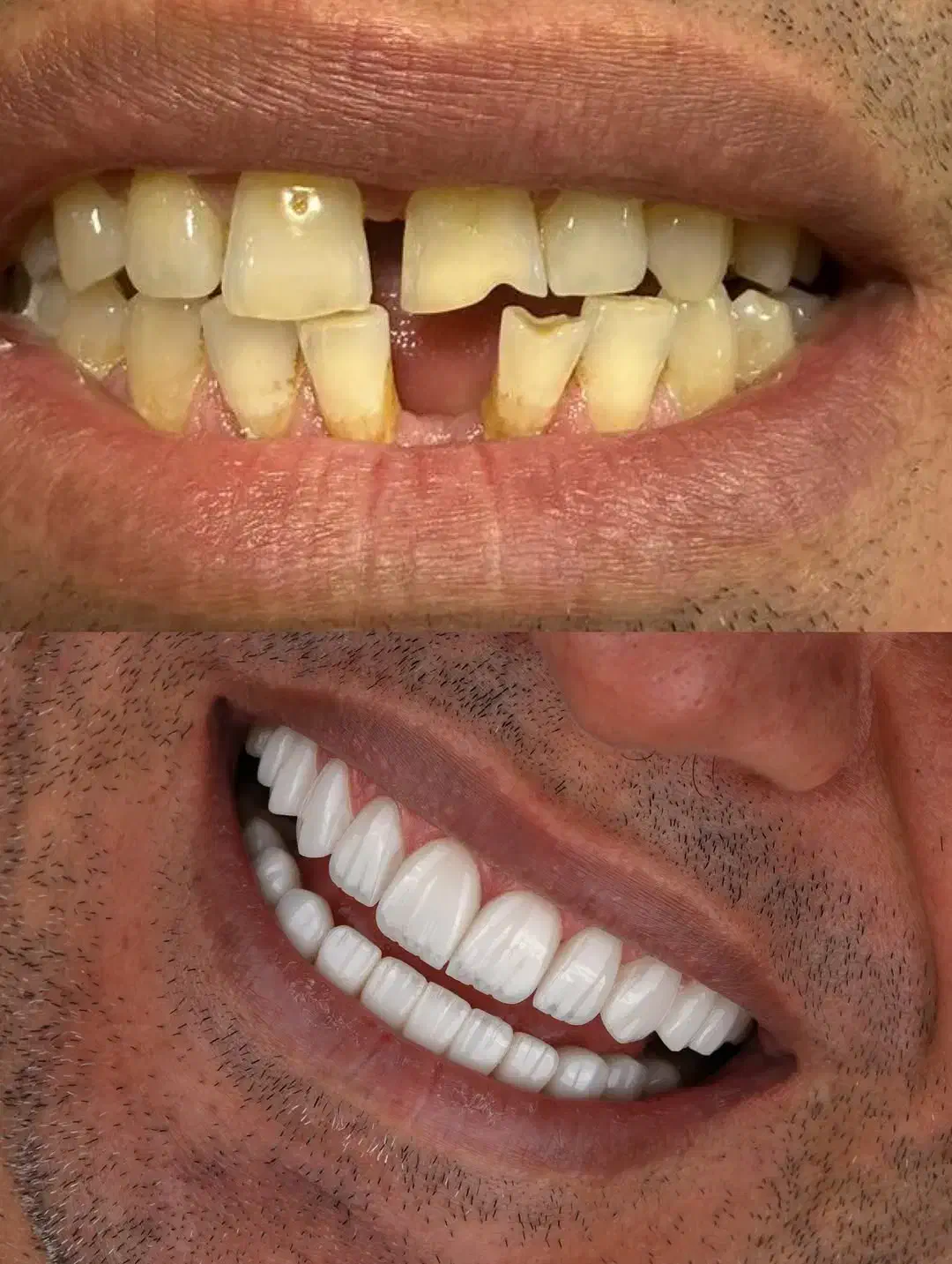 خدمات کامپوزیت آفر|خدمات آرایشگری و زیبایی|دورود, |دیوار