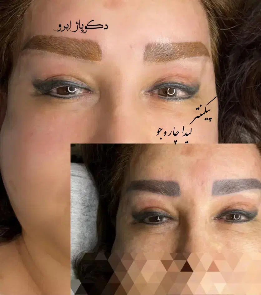 دکوپاژ ابرو روشن کردن تاتوی تیره|خدمات آرایشگری و زیبایی|رشت, استادسرا|دیوار