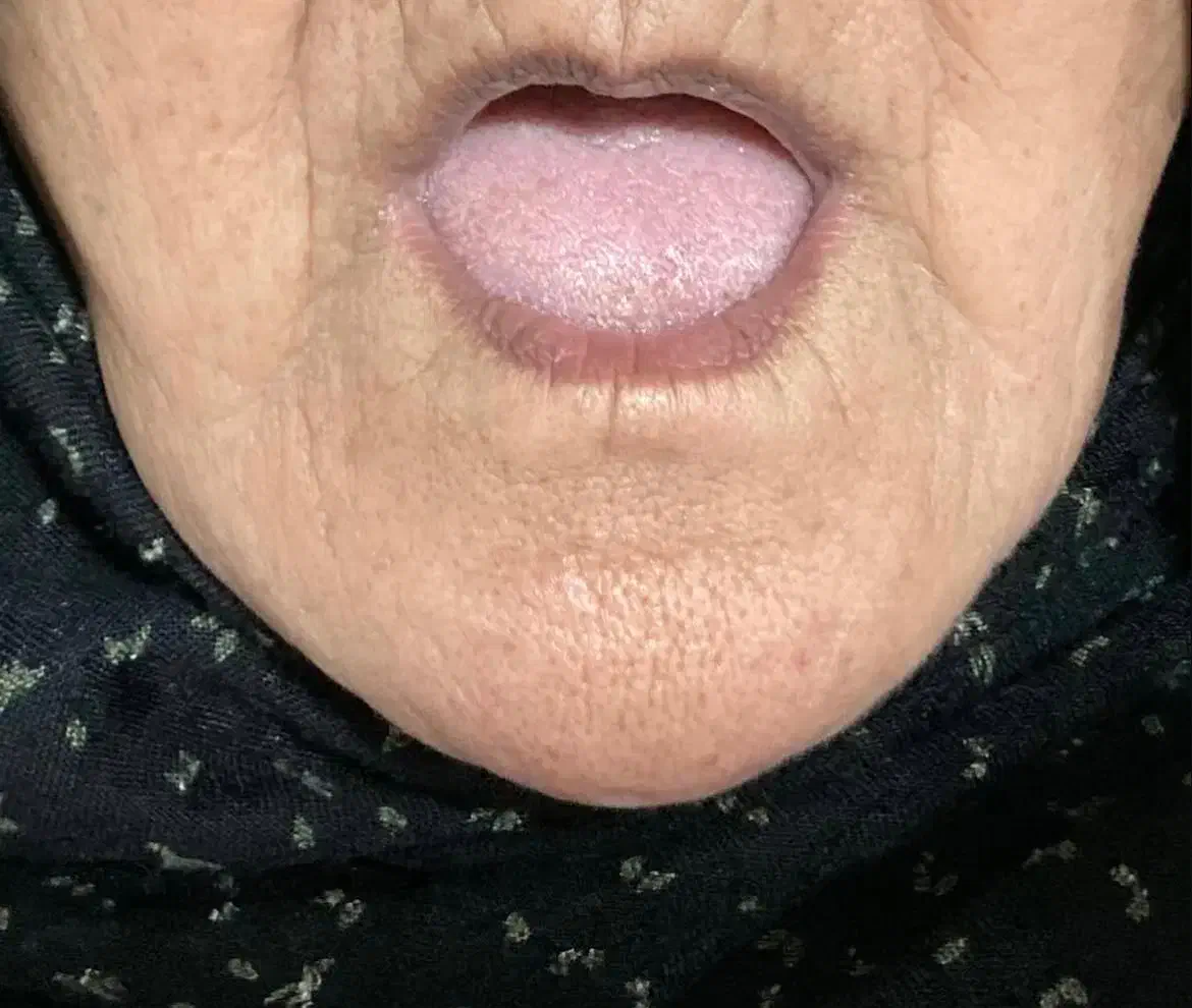 ساخت دندون مصنوعیی|پزشکی|گرگان, |دیوار