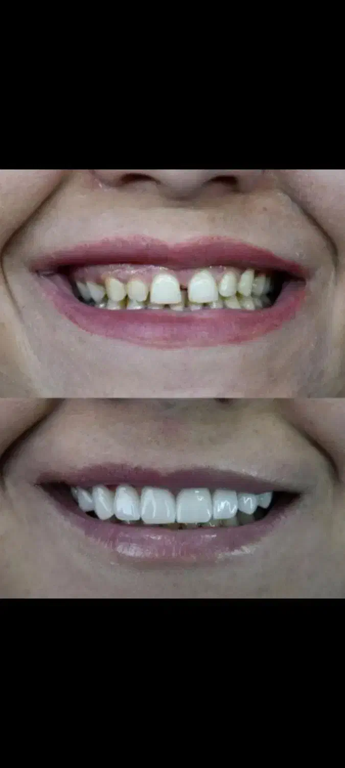 کلیه خدمات دندانپزشکی مناسب همه|خدمات آرایشگری و زیبایی|کرمانشاه, |دیوار