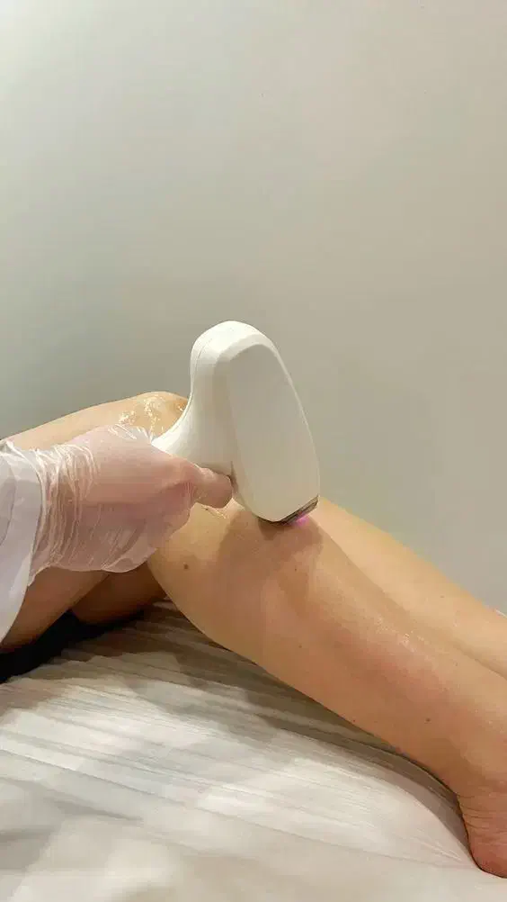 لیزر موهای زائد بدون درد -قیمت استثنایی 260ت|خدمات آرایشگری و زیبایی|ری, دولت‌آباد|دیوار