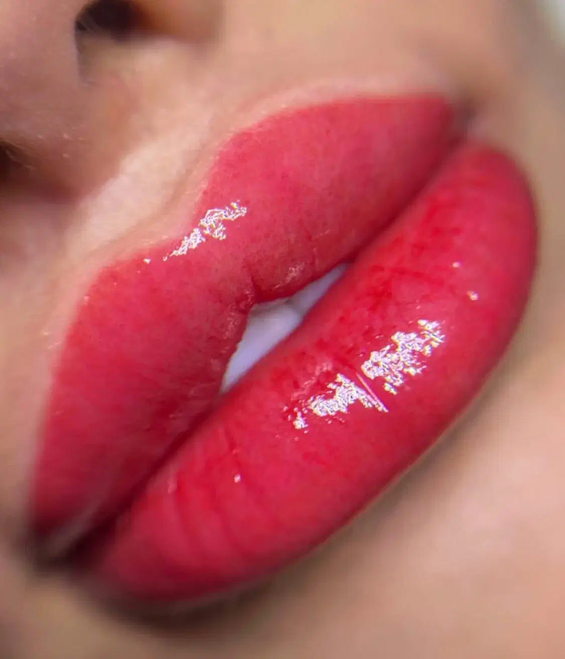 شیدینگ لب، درمان تیرگی لب (بدون درد)|خدمات آرایشگری و زیبایی|ساری, |دیوار