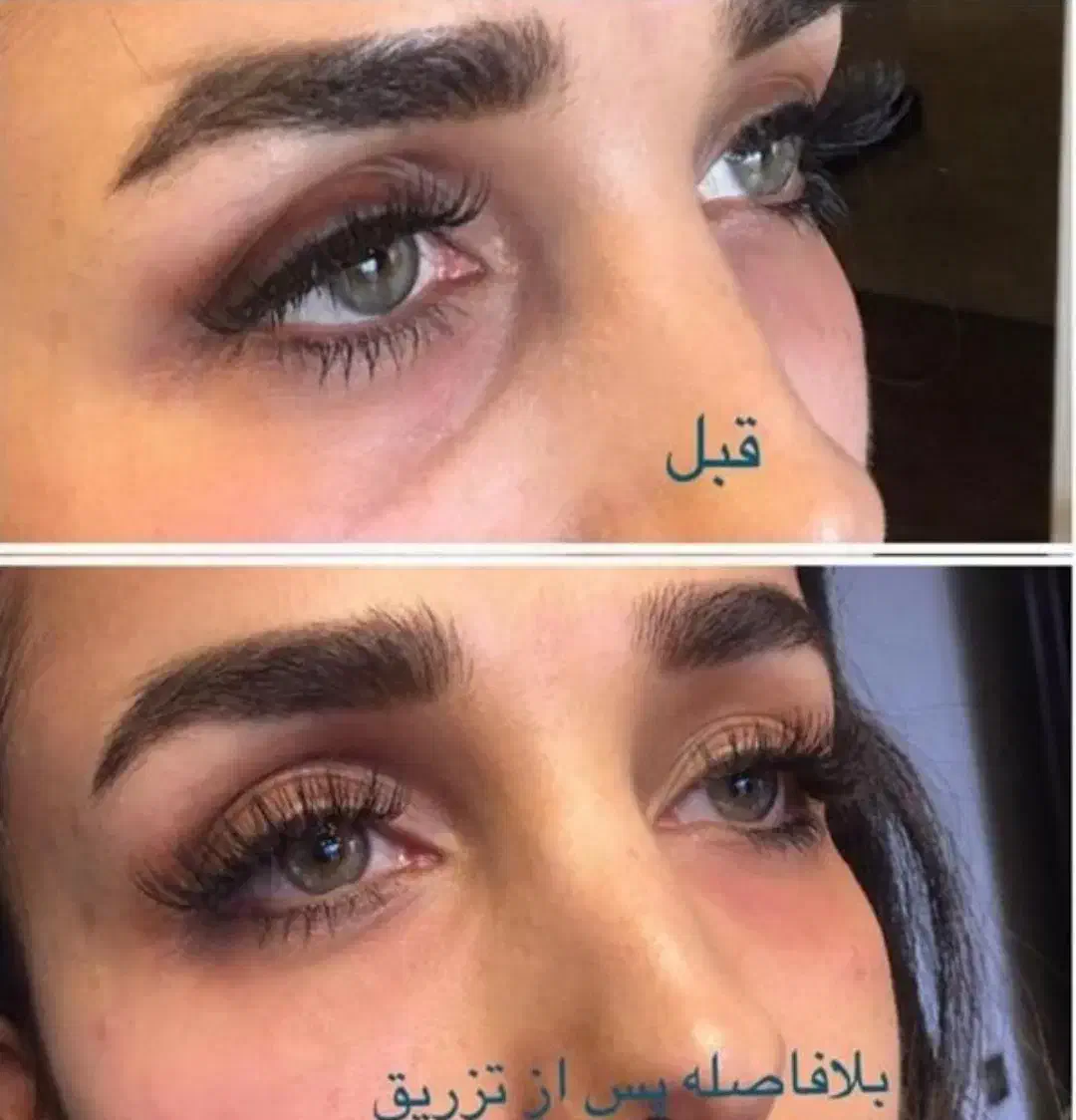 کلینیک تخصصی زیبایی/بوتاکس فیلر لاغری مزو PRP|خدمات آرایشگری و زیبایی|رفسنجان, |دیوار