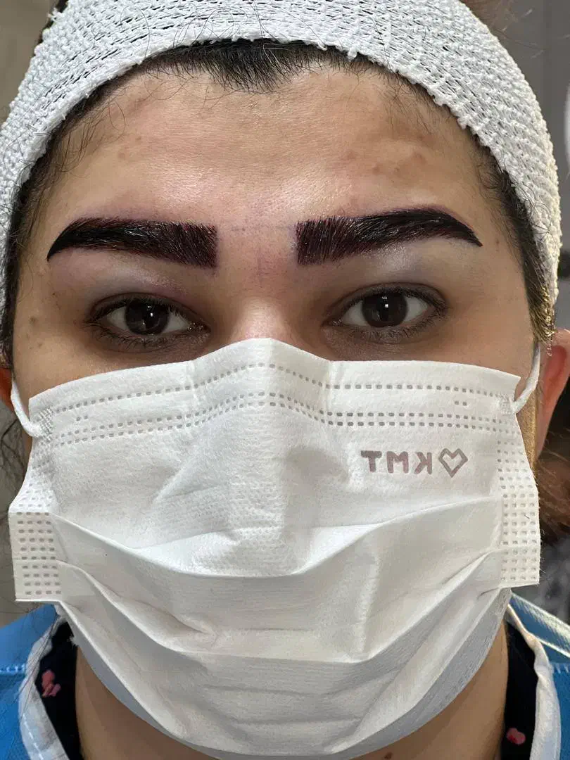 کاشت موی تخصصی تبریز|خدمات آرایشگری و زیبایی|اردبیل, |دیوار