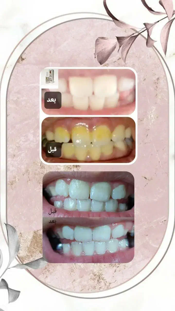 پک دهان ودندان آریا|آرایشی، بهداشتی، درمانی|سیرجان, |دیوار