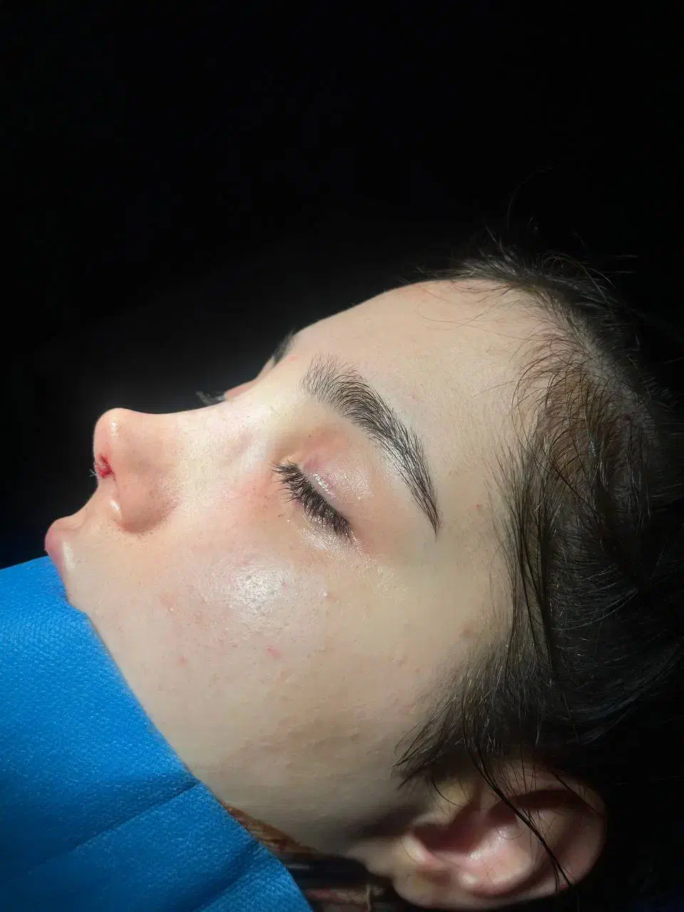 عمل بینی و لیفت صورت نقد و اقساط (بدون سود اضافه)|خدمات آرایشگری و زیبایی|تهران, الهیه|دیوار
