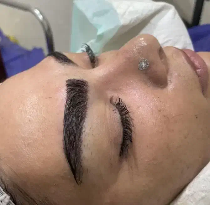 کاشت تخصصی مو در شیراز|خدمات آرایشگری و زیبایی|بوشهر, |دیوار