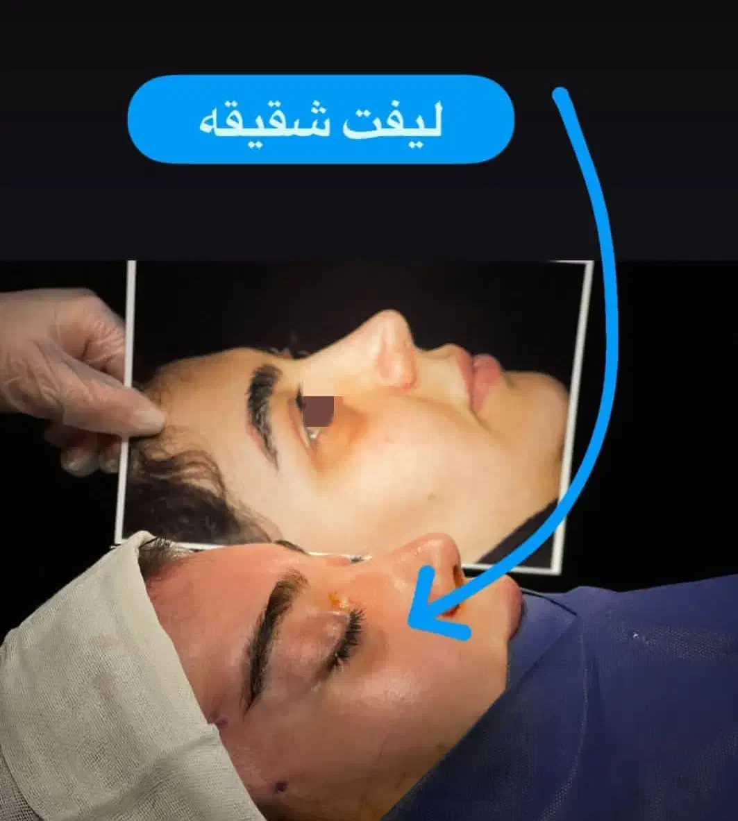 جشنواره بلفارو پلاستی پلک فقط 8500|خدمات آرایشگری و زیبایی|اصفهان, بهار آزادی|دیوار