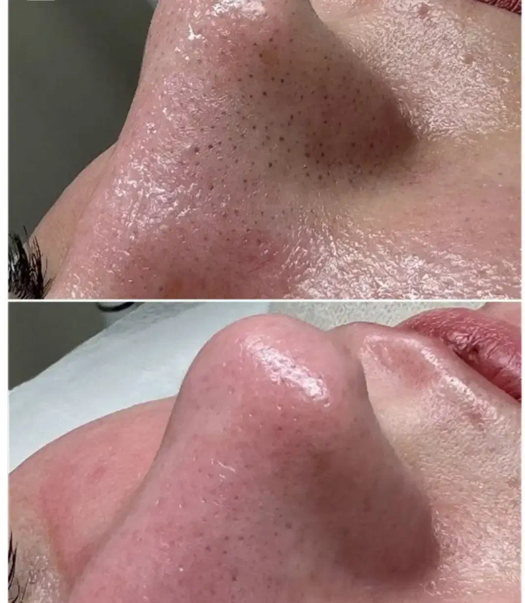 تخفیف یلدایی پاکسازی پوست فقط ۵۰۰تومن|خدمات آرایشگری و زیبایی|محمدیه-قزوین, |دیوار