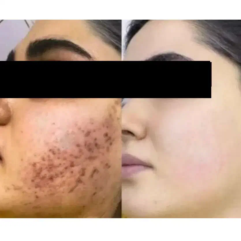 فرمول کرم سفید کننده صورت ودست پا|آرایشی، بهداشتی، درمانی|زاهدان, |دیوار