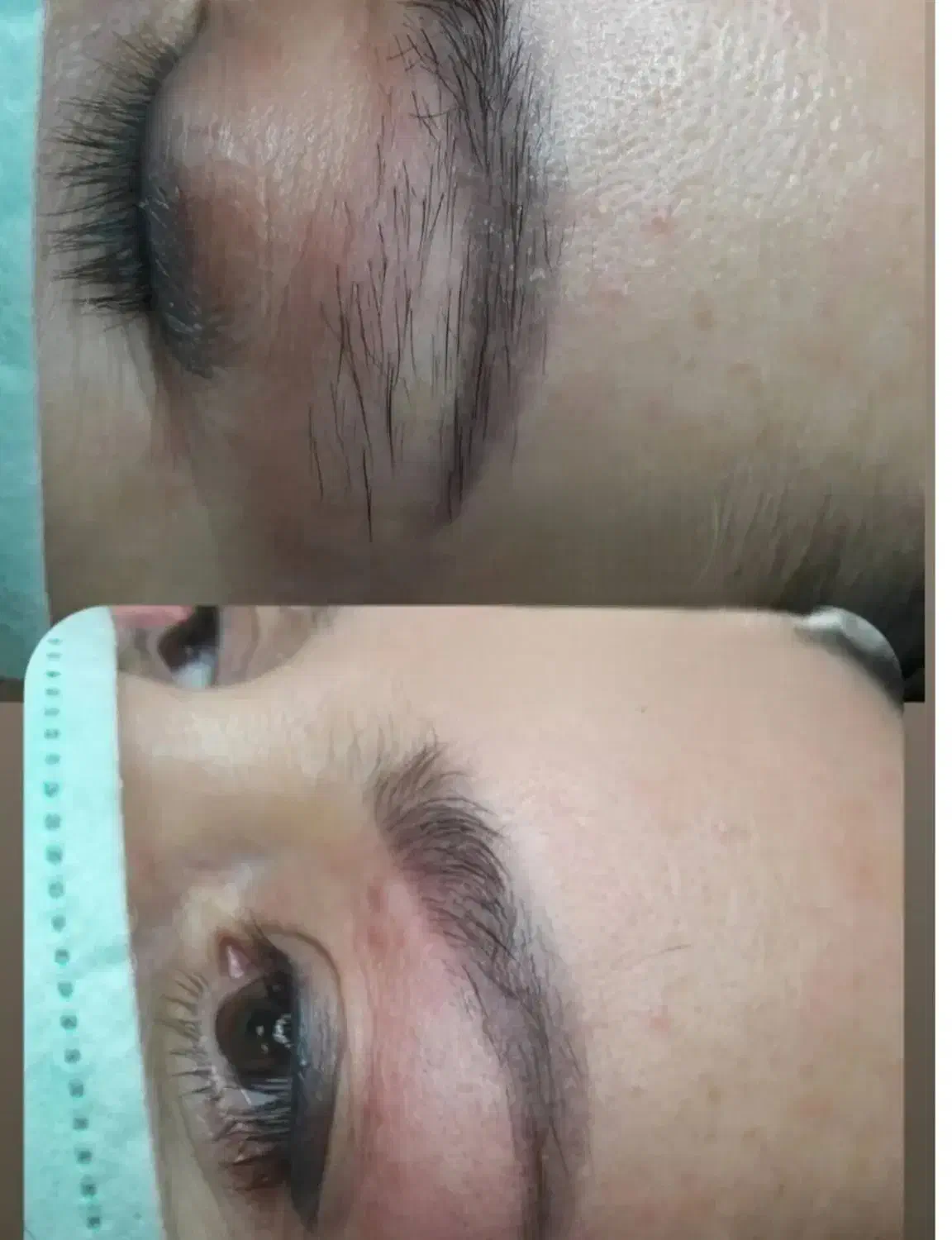 الکترولیز تنها روش قطعی از بین بردن هر نوع مو|خدمات آرایشگری و زیبایی|صدرا-فارس, فاز ۱|دیوار