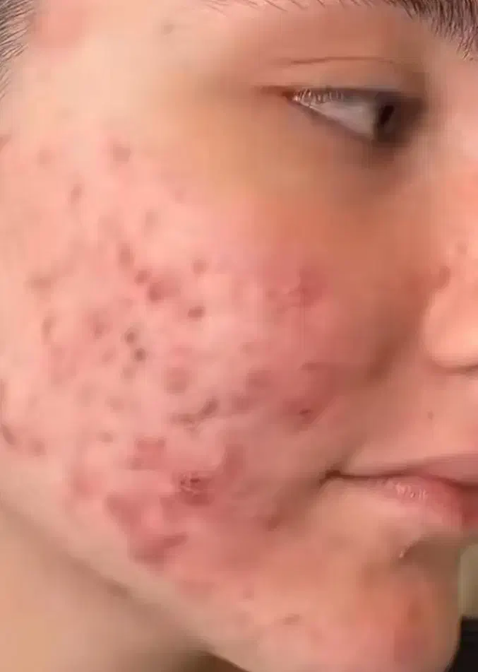 زیبایی پوست و مو|خدمات آرایشگری و زیبایی|سقز, |دیوار