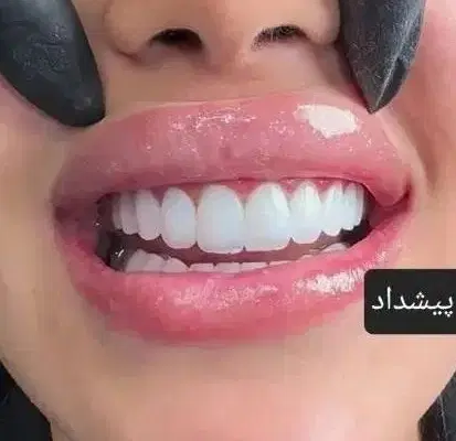 کامپوزیت *vip*|خدمات آرایشگری و زیبایی|خرم‌آباد, |دیوار