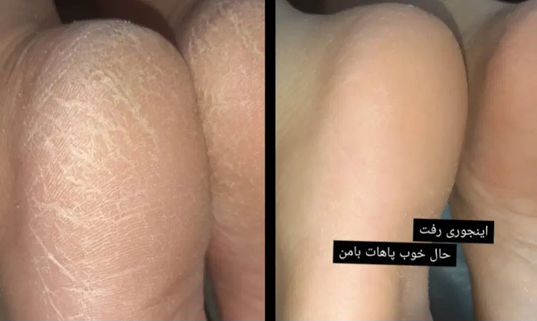 پارافین تراپی وپدیکوروکفسابی پاویژه آقایون وبانوان|خدمات آرایشگری و زیبایی|اصفهان, چشمه باقرخان|دیوار