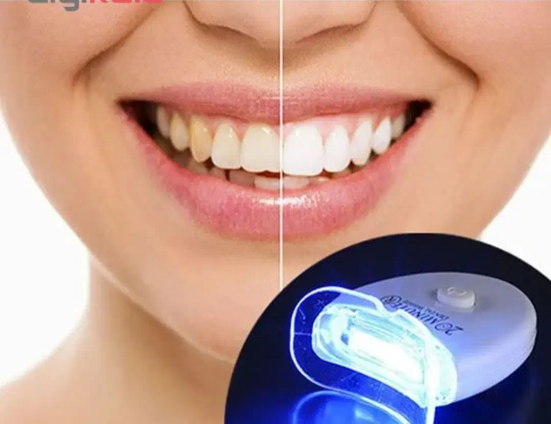 سفید کننده دندان|پزشکی|شیراز, دکتر حسابی|دیوار