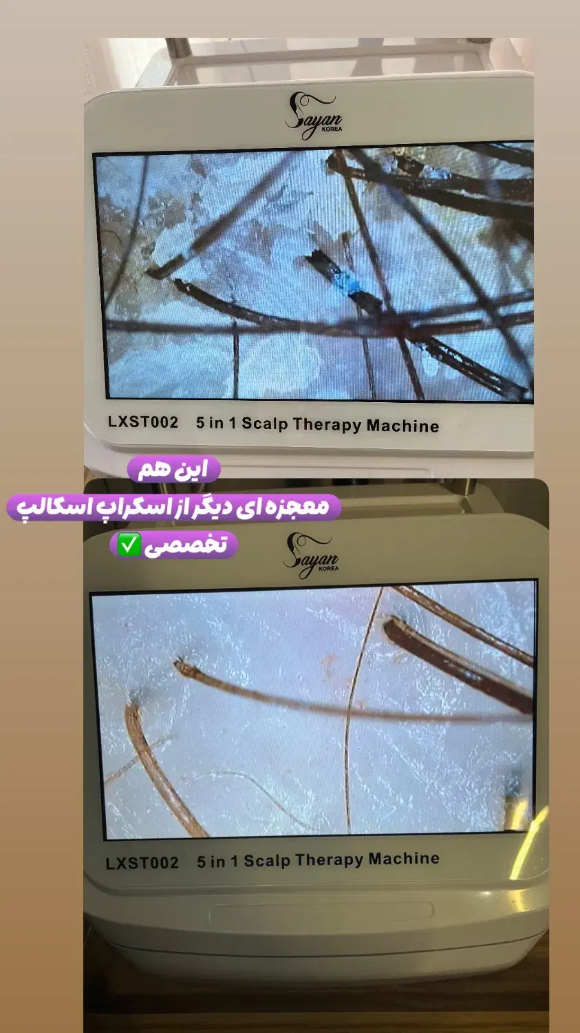 درمان قطعی شوره ،چربی،و انواع ریزش های مو|خدمات آرایشگری و زیبایی|اصفهان, چشمه باقرخان|دیوار