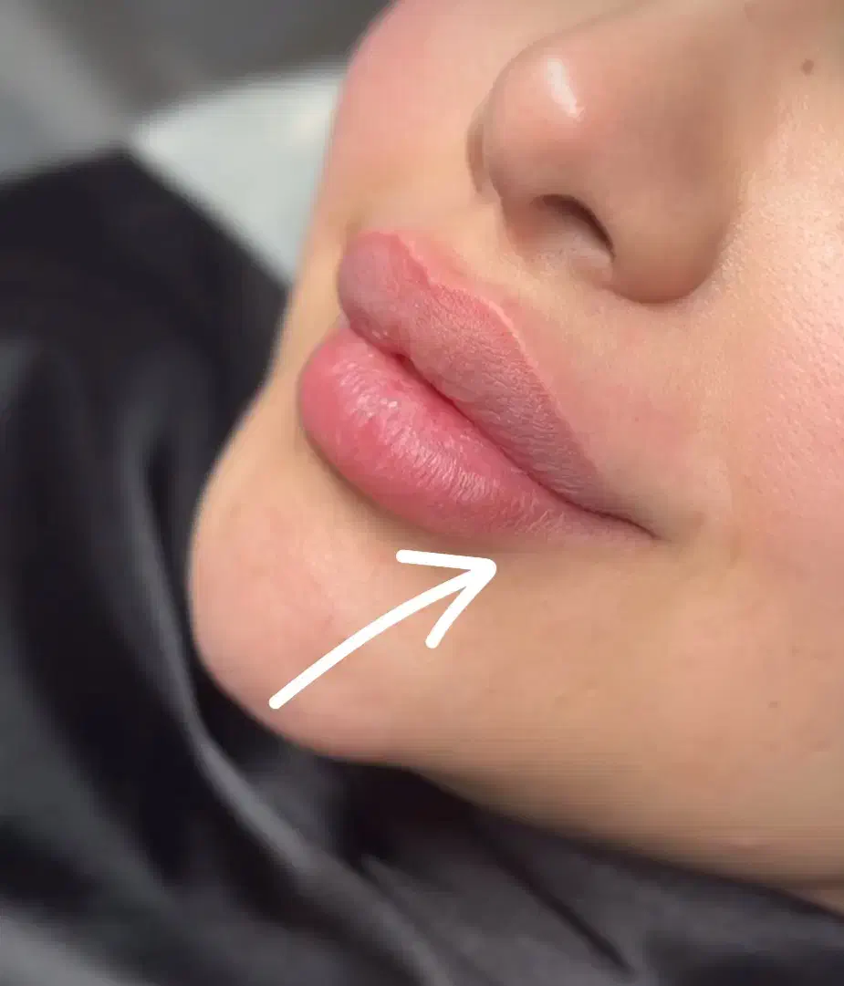 فروش و مدل ژل و بوتاکس|خدمات آرایشگری و زیبایی|اندیکا, |دیوار