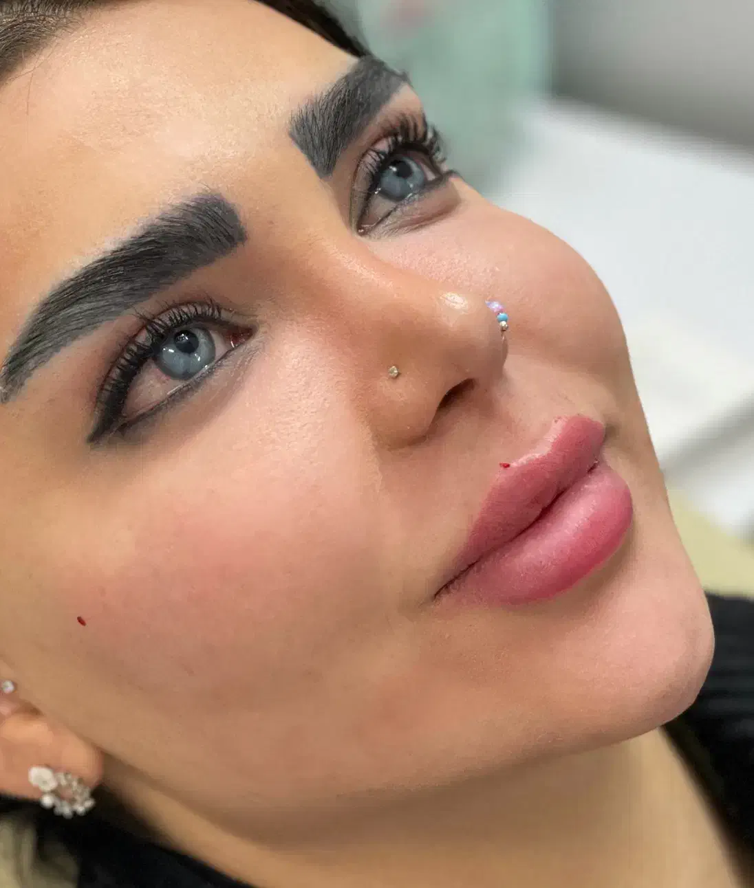 بوتاکس فیلرژل لب گونه چانه زاویه فک و صورت مادلینگ|خدمات آرایشگری و زیبایی|تهران, تهرانپارس غربی|دیوار
