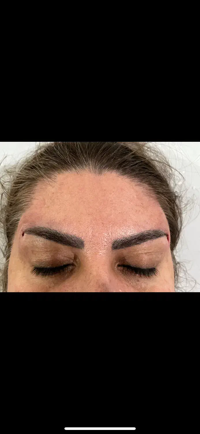 ژل و بوتاکس|خدمات آرایشگری و زیبایی|شیراز, زرهی|دیوار