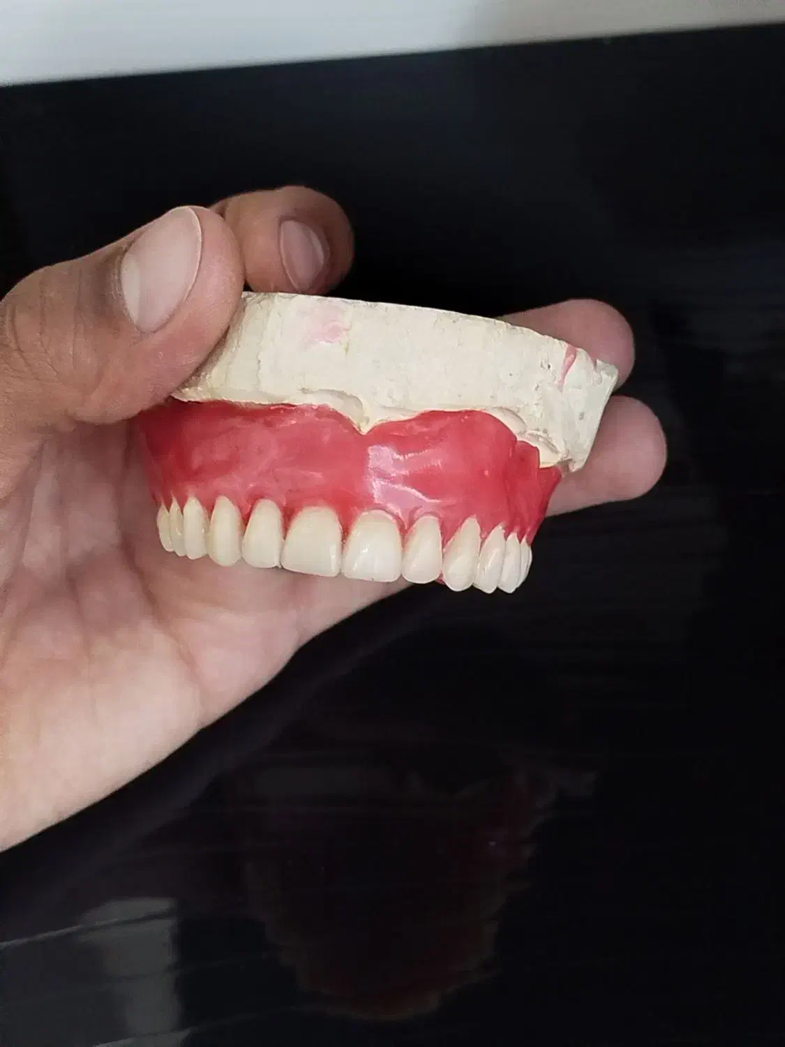 دندانسازی ،پروتر متحرک .دندان مصنوعی|خدمات آرایشگری و زیبایی|کرمانشاه, |دیوار